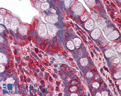 MYL12A / MRCL3 Antibody - Human Small Intestine: Formalin-Fixed, Paraffin-Embedded (FFPE)