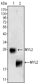 MYL2 Antibody - Western blot using MYL3 (1) and MYL2 (2) mouse monoclonal antibody against rat fetal heart tissue lysate.