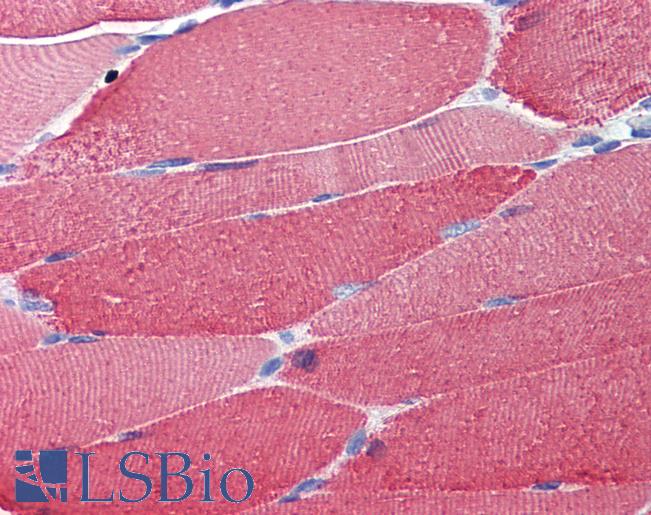 MYL2 Antibody - Anti-MYL2 antibody IHC of human skeletal muscle. Immunohistochemistry of formalin-fixed, paraffin-embedded tissue after heat-induced antigen retrieval. Antibody concentration 5 ug/ml.