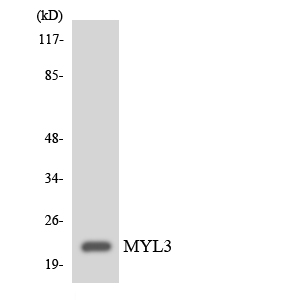 MYL3 Antibody - Western blot analysis of the lysates from HeLa cells using MYL3 antibody.