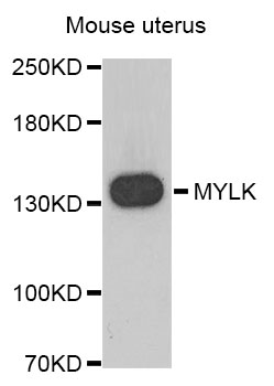 MYLK Antibody - Western blot blot of extracts of Mouse uterus, using MYLK antibody.