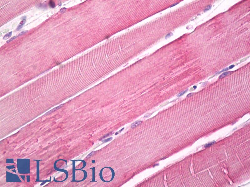 MYO10 / Myosin-X Antibody - Anti-MYO10 / MYOSIN-X antibody IHC of human skeletal muscle. Immunohistochemistry of formalin-fixed, paraffin-embedded tissue after heat-induced antigen retrieval. Antibody dilution 5 ug/ml.
