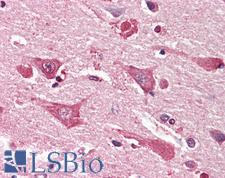 MYO1B / Myosin IB Antibody - Anti-MYO1B / Myosin IB antibody IHC staining of human brain, cortex. Immunohistochemistry of formalin-fixed, paraffin-embedded tissue after heat-induced antigen retrieval. Antibody concentration 5 ug/ml.