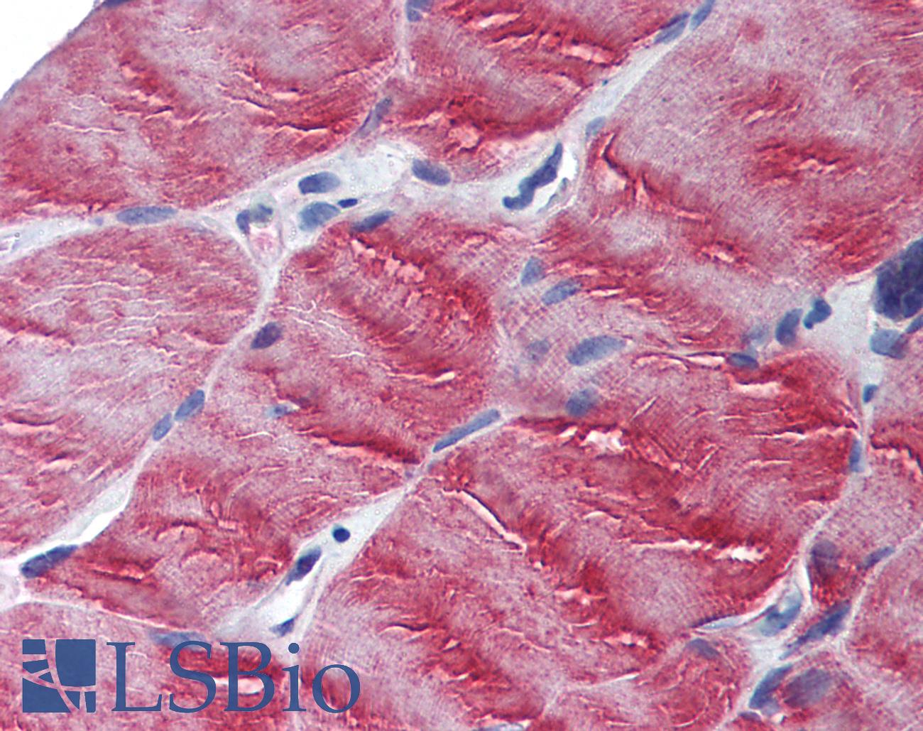 MYO5B / Myosin VB Antibody - Anti-MYO5B antibody IHC of human skeletal muscle. Immunohistochemistry of formalin-fixed, paraffin-embedded tissue after heat-induced antigen retrieval. Antibody concentration 5 ug/ml.