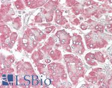 MYO5C Antibody - Human Pancreas: Formalin-Fixed, Paraffin-Embedded (FFPE)