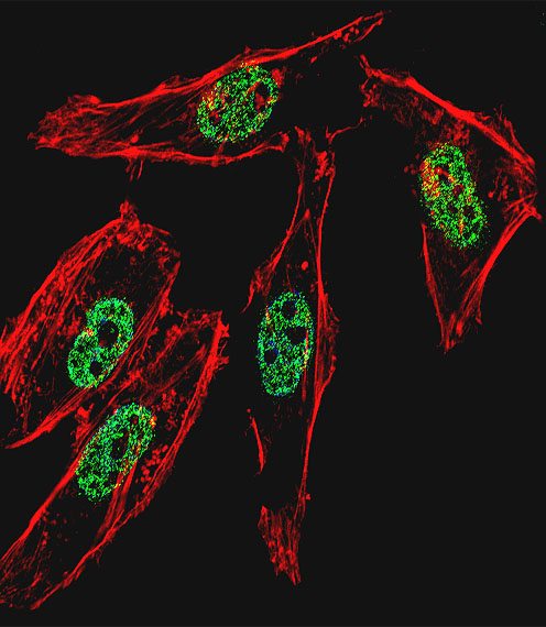 MYOD / MYOD1 Antibody - Fluorescent confocal image of HeLa cell stained with MyoD1 Antibody. HeLa cells were fixed with 4% PFA (20 min), permeabilized with Triton X-100 (0.1%, 10 min), then incubated with MyoD1 primary antibody (1:25, 1 h at 37°C). For secondary antibody, Alexa Fluor 488 conjugated donkey anti-rabbit antibody (green) was used (1:400, 50 min at 37°C). Cytoplasmic actin was counterstained with Alexa Fluor 555 (red) conjugated Phalloidin (7units/ml, 1 h at 37°C). Nuclei were counterstained with DAPI (blue) (10 ug/ml, 10 min). MyoD1 immunoreactivity is localized to nucleus significantly.