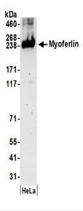 MYOF / Myoferlin Antibody - Detection of Human Myoferlin by Western Blot. Samples: Whole cell lysate (50 ug) prepared using NETN buffer from HeLa cells. Antibodies: Affinity purified rabbit anti-Myoferlin antibody used for WB at 0.4 ug/ml. Detection: Chemiluminescence with an exposure time of 3 minutes.