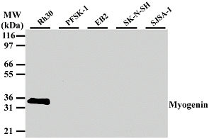 MYOG / Myogenin Antibody - Western blot of Myogenin expression in various small-round cell tumor lines using anti-Myogenin (antibody) mAb. The antibody strongly reacted with a band of approx. 34 kDa in alveolar rhabdomyosarcoma cell line (Rh30). All other small-round cell t