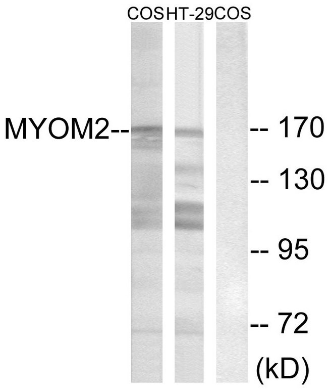 MYOM2 / Myomesin 2 Antibody - Western blot analysis of lysates from COS7 and HT-29 cells, using MYOM2 Antibody. The lane on the right is blocked with the synthesized peptide.