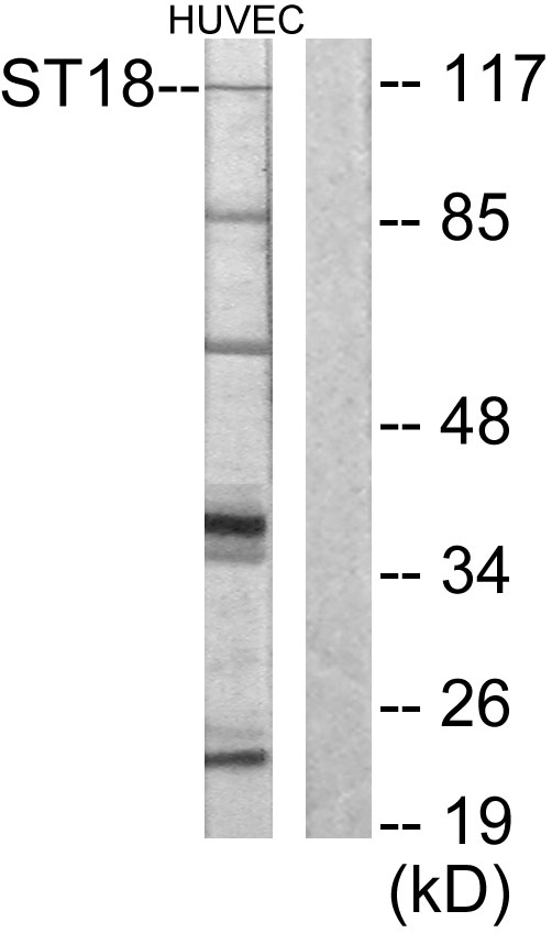 MYT1 Antibody - Western blot analysis of lysates from HUVEC cells, using ZNF387 Antibody. The lane on the right is blocked with the synthesized peptide.