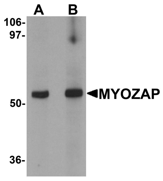 MYZAP Antibody - Western blot analysis of MYOZAP in rat kidney tissue lysate with MYOZAP antibody at (A) 1 and (B) 2 ug/ml.