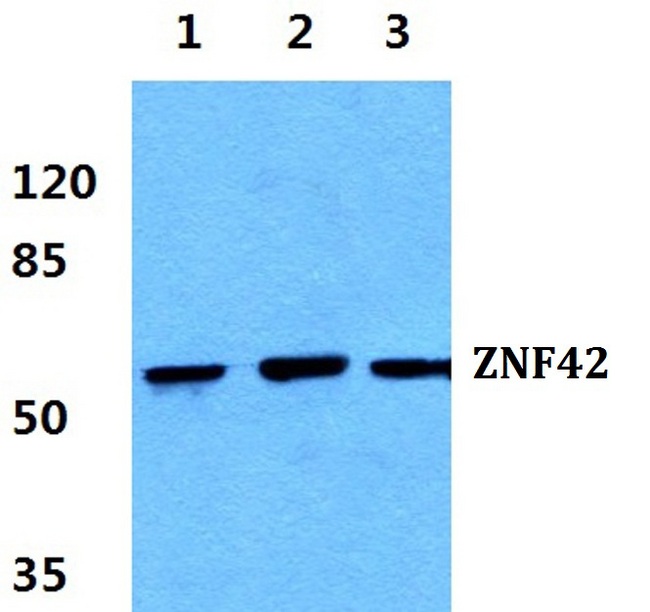 MZF / MZF1 Antibody - Western blot (WB) analysis of Anti-ZNF42 Antibody at 1:500 dilution. Lane1: HEK293T cell lysate. Lane2: sp2/0 cell lysate. Lane3: PC12 cell lysate.