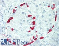 N6AMT1 Antibody - Human Pancreas: Formalin-Fixed, Paraffin-Embedded (FFPE), at a concentration of 10 ug/ml. 