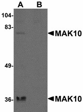 NAA35 Antibody - Western blot of MAK10 in rat heart tissue lysate with MAK10 antibody at 1 ug/ml in the (A) absence and (B) presence of blocking peptide. 