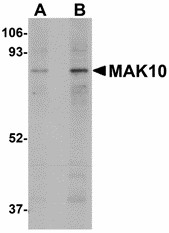 NAA35 Antibody - Western blot of MAK10 in mouse heart tissue lysate with MAK10 antibody at (A) 1 and (B) 2 ug/ml.