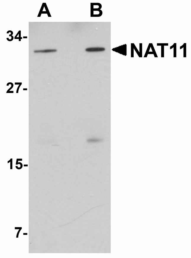 NAA40 Antibody - Western blot of NAT11 in human thymus tissue lysate with NAT11 antibody at (A) 1 and (B) 2 ug/ml.