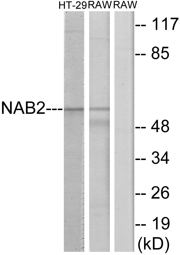 NAB2 Antibody - Western blot analysis of lysates from HT-29 and RAW264.7 cells, using NAB2 Antibody. The lane on the right is blocked with the synthesized peptide.
