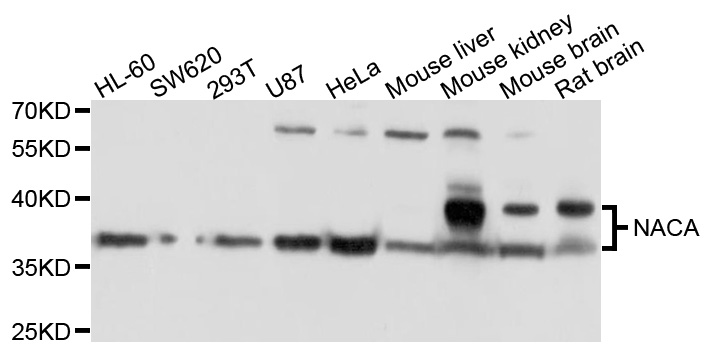 NACA Antibody - Western blot analysis of extracts of various cell lines, using NACA antibody at 1:1000 dilution. The secondary antibody used was an HRP Goat Anti-Rabbit IgG (H+L) at 1:10000 dilution. Lysates were loaded 25ug per lane and 3% nonfat dry milk in TBST was used for blocking. An ECL Kit was used for detection and the exposure time was 10s.