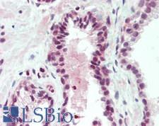 NACC1 / NAC1 Antibody - Human Prostate: Formalin-Fixed, Paraffin-Embedded (FFPE)