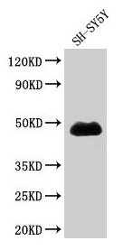 NADK / NAD Kinase Antibody - Western Blot Positive WB detected in: RAW264.7 whole cell lysate All lanes: NADK antibody at 2.5µg/ml Secondary Goat polyclonal to rabbit IgG at 1/50000 dilution Predicted band size: 50, 64, 47 kDa Observed band size: 50 kDa