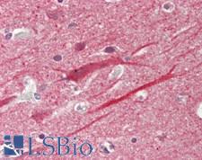 NAK / TBK1 Antibody - Human Brain, Cortex: Formalin-Fixed, Paraffin-Embedded (FFPE)