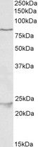 NAK / TBK1 Antibody - TBK1 antibody (1 ug/ml) staining of HeLa lysate (35 ug protein in RIPA buffer). Primary incubation was 1 hour. Detected by chemiluminescence.