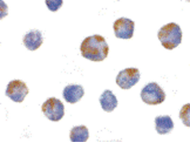NALP1 / NLRP1 Antibody - Immunocytochemistry of NALP1 in K562 cells with NALP1 antibody at 10 ug/ml.