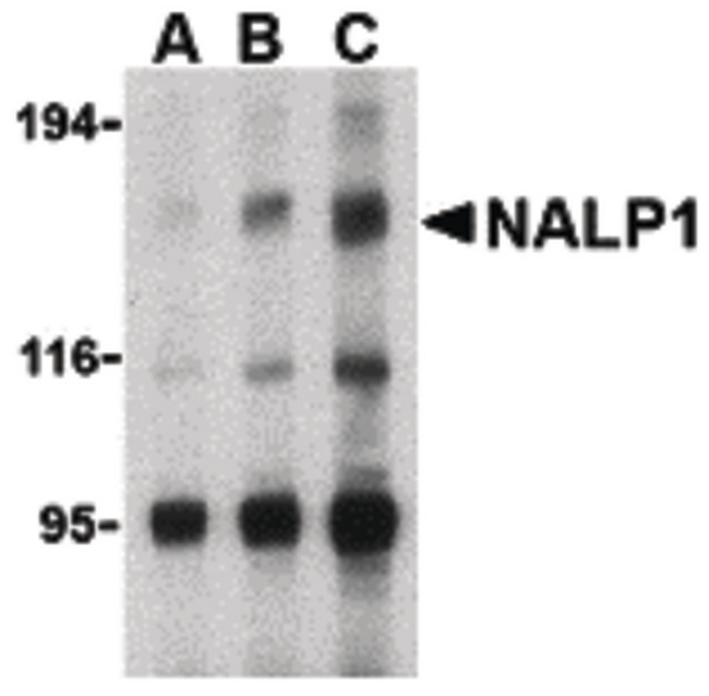 NALP1 / NLRP1 Antibody - Western blot of NALP1 in U937 cell lysate with NALP1 antibody at (A) 1, (B) 2 and (C) 4 ug/ml.