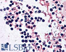 NALP3 / NLRP3 Antibody - Anti-NLRP3 antibody IHC of human peripheral blood leukocytes. Immunohistochemistry of formalin-fixed, paraffin-embedded tissue after heat-induced antigen retrieval. Antibody concentration 5 ug/ml.