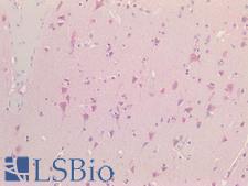 NALP3 / NLRP3 Antibody - Human Brain, Cortex: Formalin-Fixed, Paraffin-Embedded (FFPE) HIER using 10 mM sodium citrate buffer pH 6.0