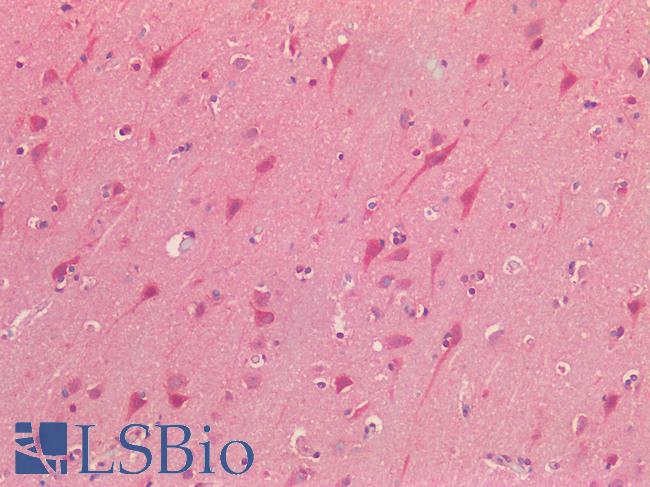 NALP3 / NLRP3 Antibody - Human Brain, Cortex: Formalin-Fixed, Paraffin-Embedded (FFPE) HIER using 10 mM sodium citrate buffer pH 6.0