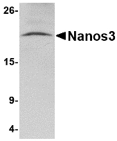 NANOS3 / NOS-3 Antibody - Western blot of Nanos3 in human brain tissue lysate with Nanos3 antibody at 2 ug/ml.