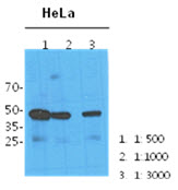 NANS Antibody - Western Blot: The cell lysates (40 ug) were resolved by SDS-PAGE, transferred to PVDF membrane and probed with anti-human NANS antibody (1:100, 1:1000, 1:3000). Proteins were visualized using a goat anti-mouse secondary antibody conjugated to HRP and an ECL detection system.