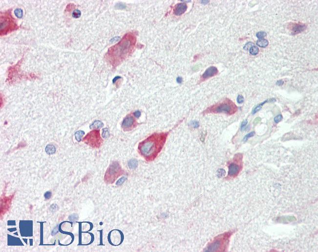NARG1 / NAA15 Antibody - Anti-NARG1 / NAA15 antibody IHC staining of human brain, cortex. Immunohistochemistry of formalin-fixed, paraffin-embedded tissue after heat-induced antigen retrieval. Antibody dilution 1:100.