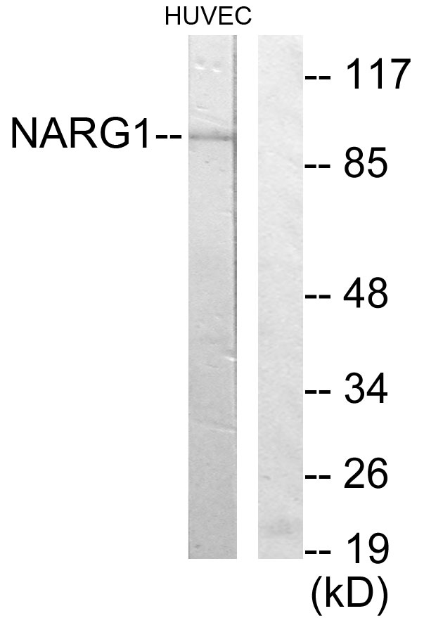 NARG1 / NAA15 Antibody - Western blot analysis of lysates from HUVEC cells, using NARG1 Antibody. The lane on the right is blocked with the synthesized peptide.