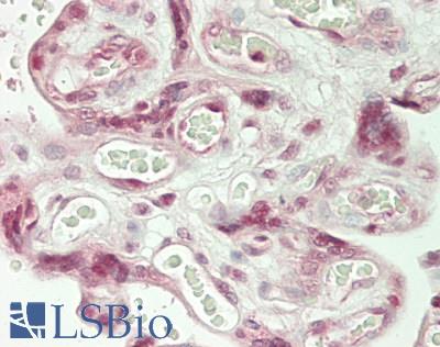 NARG1 / NAA15 Antibody - Human Placenta: Formalin-Fixed, Paraffin-Embedded (FFPE)