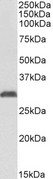 NAT1 / AAC1 Antibody - NAT1 antibody (1 ug/ml) staining of Human Erythrocytes lysate (35 ug protein in RIPA buffer). Primary incubation was 1 hour. Detected by chemiluminescence.