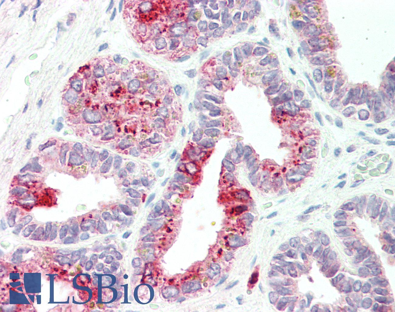 NAT1 / AAC1 Antibody - Anti-NAT1 / AAC1 antibody IHC staining of human urethra. Immunohistochemistry of formalin-fixed, paraffin-embedded tissue after heat-induced antigen retrieval. Antibody concentration 5 ug/ml.