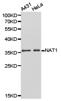 NAT1 / AAC1 Antibody - Western blot of extracts of various cell lines, using NAT1 antibody.