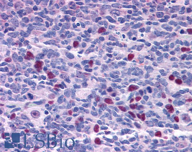 NAT10 Antibody - Anti-NAT10 antibody IHC of human tonsil. Immunohistochemistry of formalin-fixed, paraffin-embedded tissue after heat-induced antigen retrieval. Antibody concentration 3.75 ug/ml.