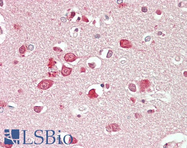 NBEA / Neurobeachin Antibody - Anti-NBEA / Neurobeachin antibody IHC staining of human brain, cortex. Immunohistochemistry of formalin-fixed, paraffin-embedded tissue after heat-induced antigen retrieval. Antibody concentration 10 ug/ml.