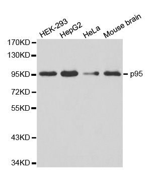 NBN / Nibrin Antibody - Western blot analysis of extracts of various cell lines, using NBN antibody.