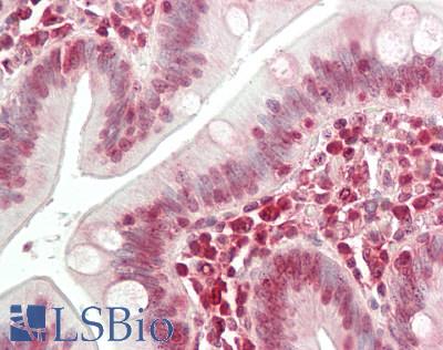 NBN / Nibrin Antibody - Human Small Intestine: Formalin-Fixed, Paraffin-Embedded (FFPE)