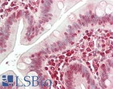 NBN / Nibrin Antibody - Human Small Intestine: Formalin-Fixed, Paraffin-Embedded (FFPE)