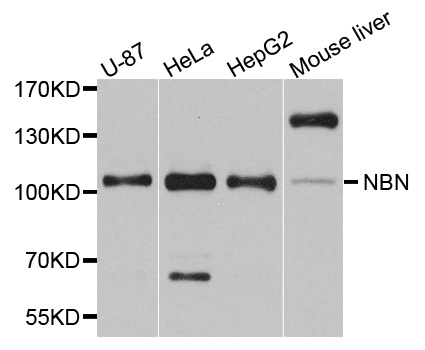 NBN / Nibrin Antibody - Western blot analysis of extracts of various cell lines, using NBN antibody at 1:1000 dilution. The secondary antibody used was an HRP Goat Anti-Rabbit IgG (H+L) at 1:10000 dilution. Lysates were loaded 25ug per lane and 3% nonfat dry milk in TBST was used for blocking. An ECL Kit was used for detection and the exposure time was 90s.