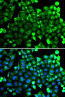 NCALD / Neurocalcin Delta Antibody - Immunofluorescence analysis of A549 cells.