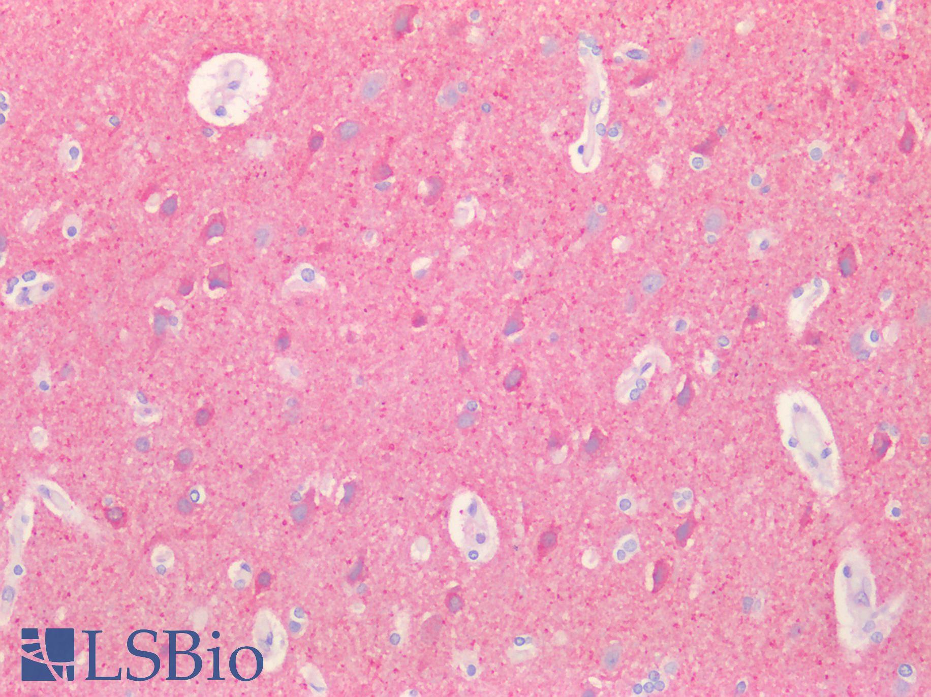 NCALD / Neurocalcin Delta Antibody - Human Brain, Cortex: Formalin-Fixed, Paraffin-Embedded (FFPE)