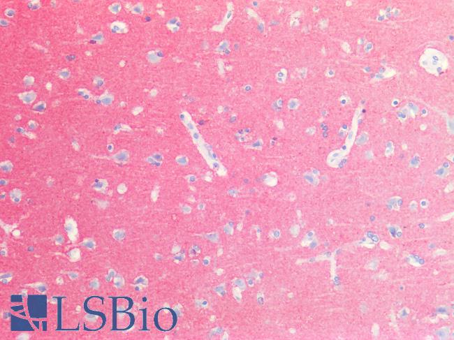 NCAM / CD56 Antibody - Human Brain, Cortex: Formalin-Fixed, Paraffin-Embedded (FFPE)