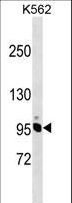 NCAPH / CAP-H Antibody - NCAPH Antibody western blot of K562 cell line lysates (35 ug/lane). The NCAPH antibody detected the NCAPH protein (arrow).