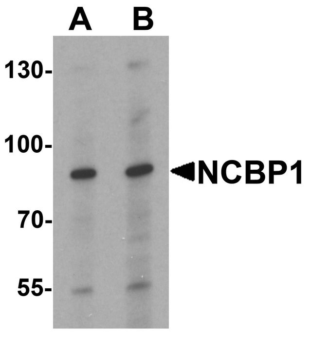 NCBP1 / CBP80 Antibody - Western blot analysis of NCBP1 in HeLa cell lysate with NCBP1 antibody at (A) 1 and (B) 2 ug/ml.